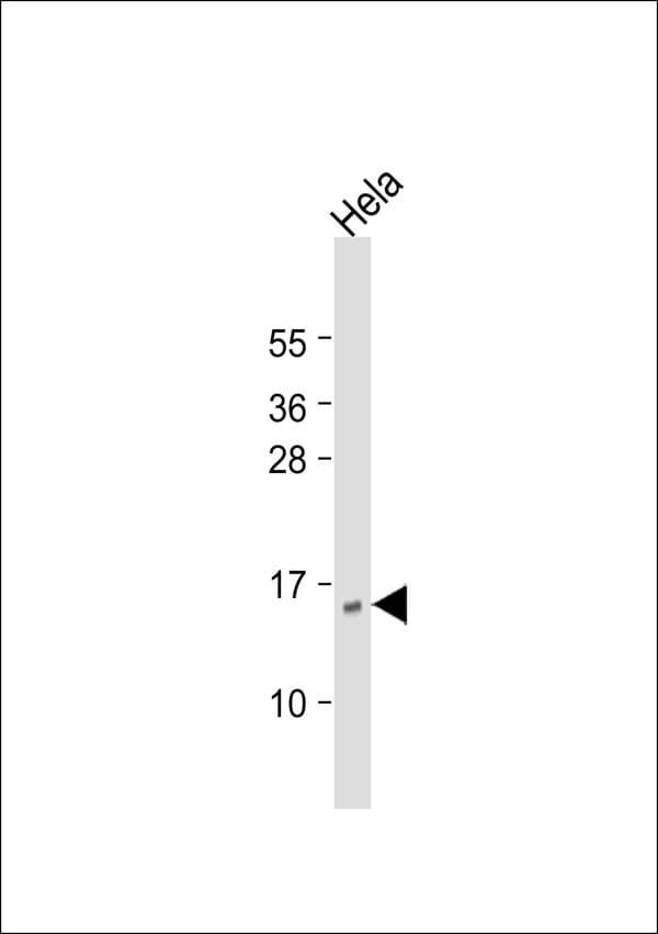 CD225 / IFITM1 Antibody