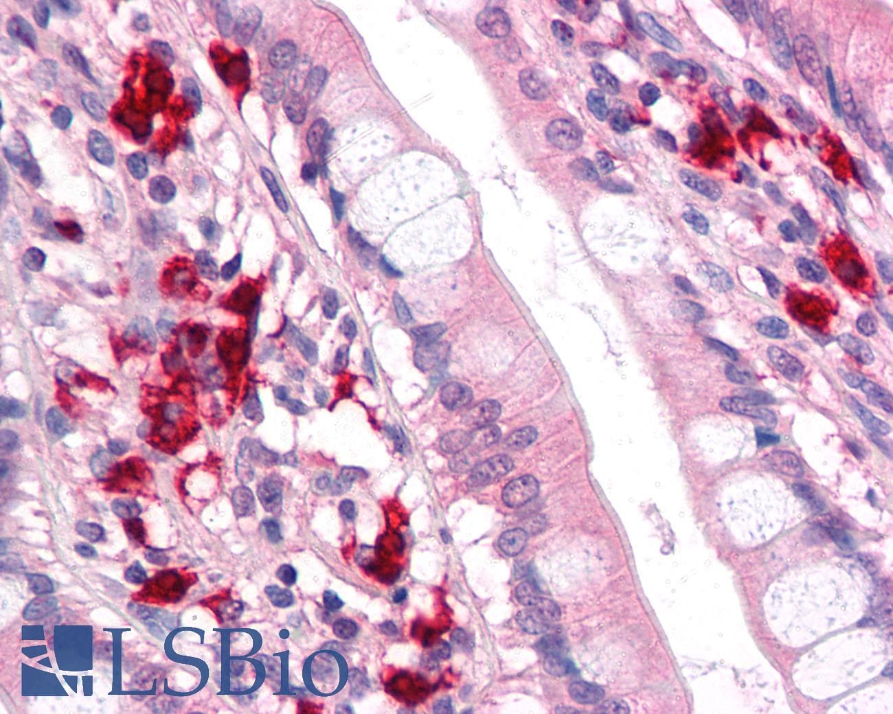 IHC-plus™ Polyclonal Rabbit anti-Human TFF2 / SP Antibody (Internal)