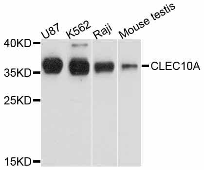 CLEC10A / CD301 Antibody