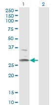 HSD11B1 / HSD11B Antibody (clone 2C10)