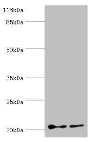 Polyclonal Rabbit anti-Human UBCH10 / UBE2C Antibody (aa2-179, IHC, WB)