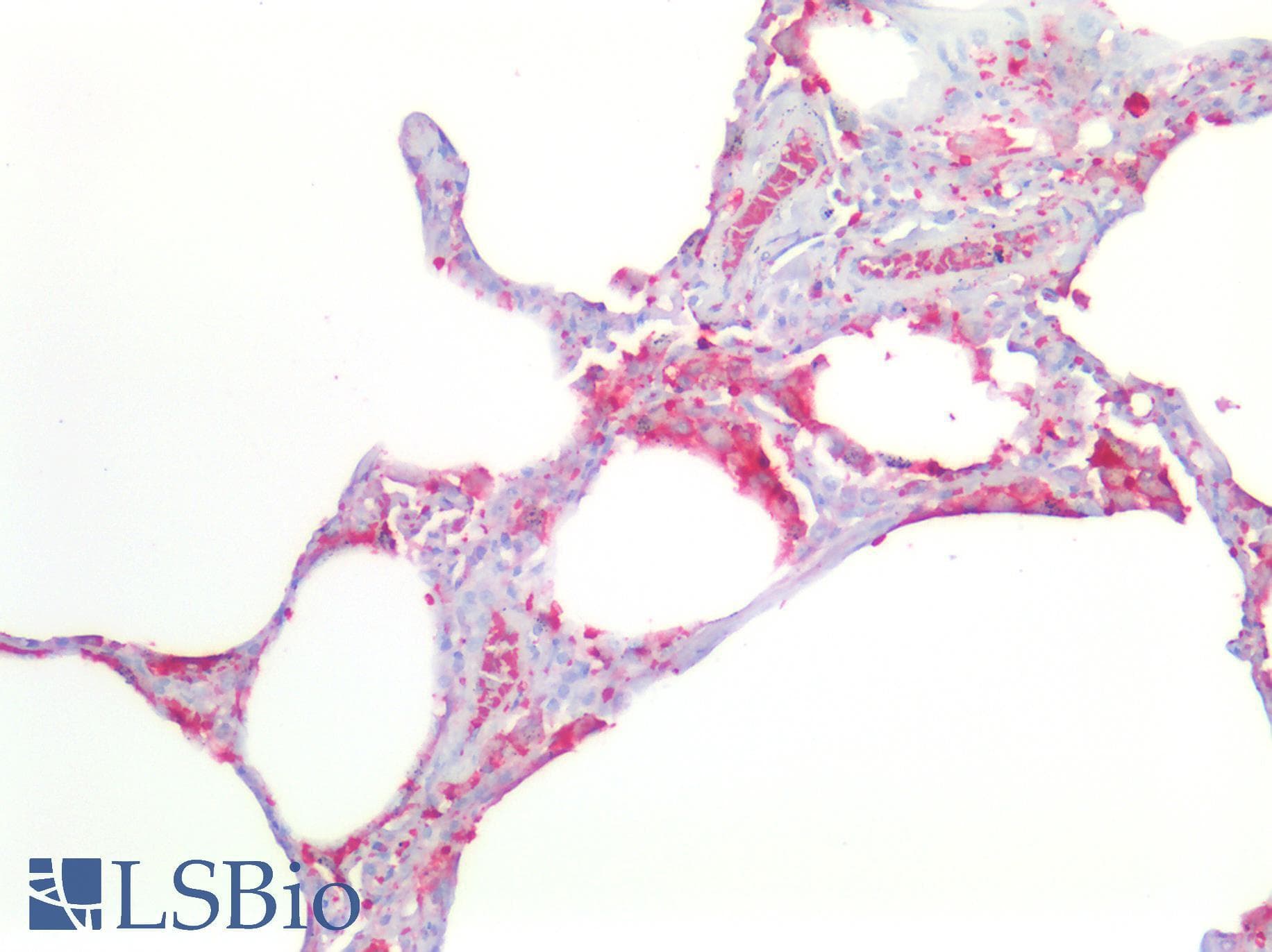 FTL / Ferritin Light Chain Antibody (aa5-183)