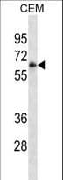 Monoclonal Mouse anti-Human FCGR3A / CD16A Antibody (aa60-88, WB)