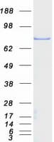 Human ALOX5 / 5-LOX Protein (Recombinant Myc-DDK (Flag))