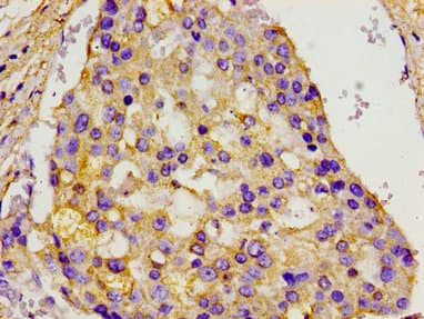 Polyclonal Rabbit anti-Human MCM3AP / GANP Antibody (IHC)