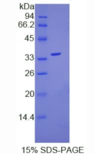 Human HLA-C Protein (Recombinant His, N-terminus)