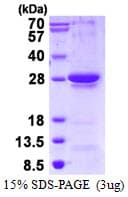 Human RGS1 Protein (Recombinant His)