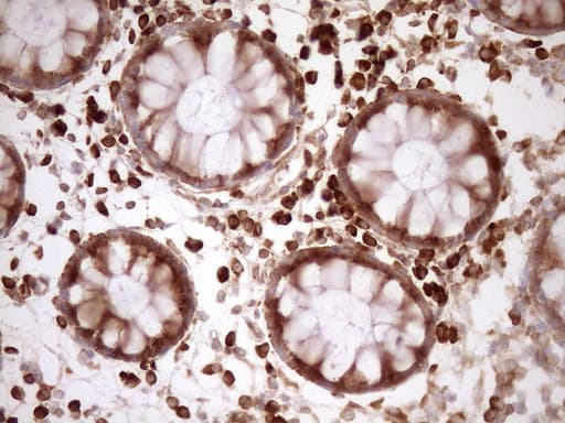 RPL10 / Ribosomal Protein L10 Antibody (clone OTI6B11)