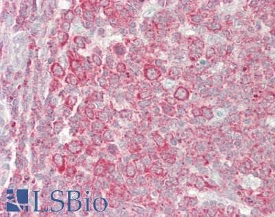 IHC-plus™ Polyclonal Rabbit anti-Human c-Src Kinase / CSK Antibody (aa375-425, IHC)