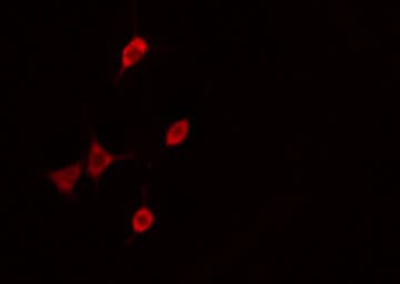 CDKN1B / p27 Kip1 Antibody