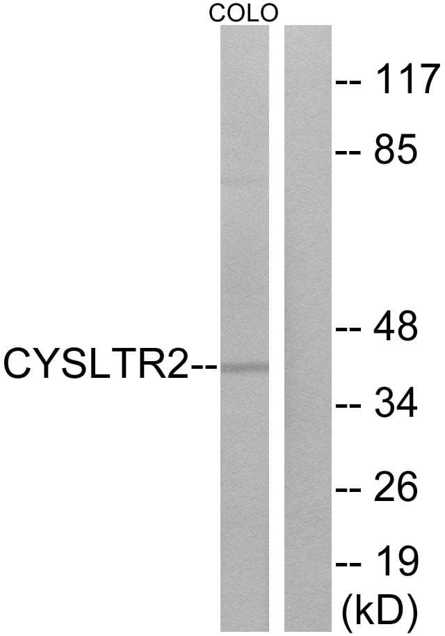 Polyclonal Rabbit anti-Human CYSLT2 / CYSLTR2 Antibody (WB)