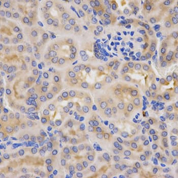 Polyclonal Rabbit anti-Human CFB / Complement Factor B Antibody (IHC, WB)