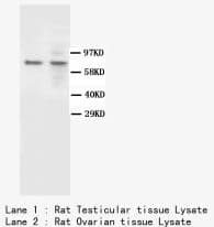 BAP1 Antibody (clone BP-1, Sepharose)