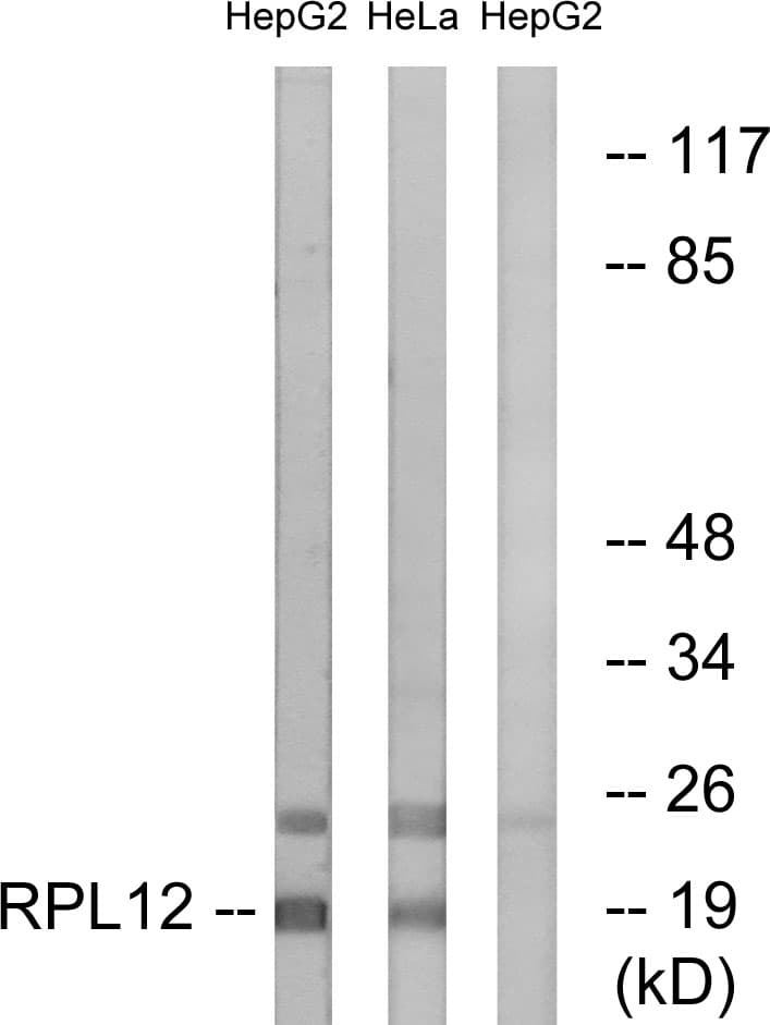 IHC-plus™ RPL12 / Ribosomal Protein L12 Antibody (aa61-110)