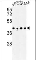 Polyclonal Rabbit anti-Human CANT1 Antibody (aa1-30, WB)