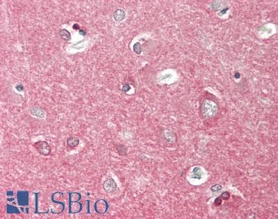 PathPlus™ MAPT / Tau Antibody (clone MCA-2E9)