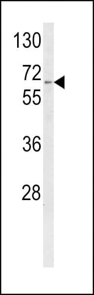 Polyclonal Rabbit anti-Human CYP4F3 Antibody (aa77-109, WB)
