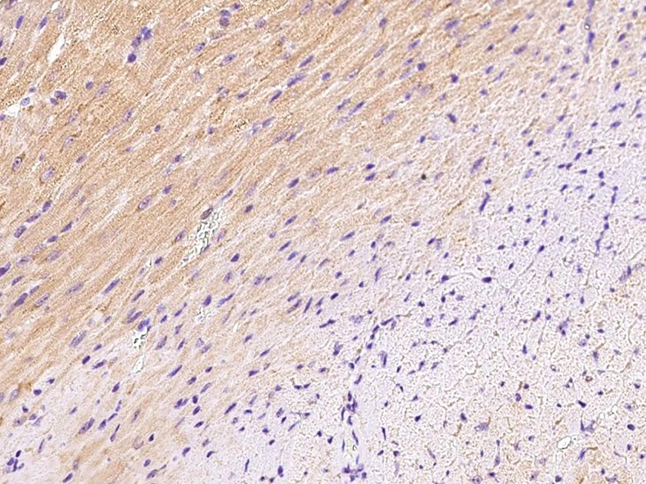 SFRP1 Antibody