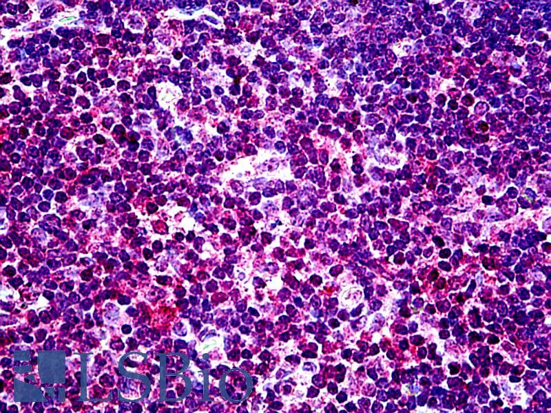 IHC-plus™ Polyclonal Goat anti-Human Testilin / EHD1 Antibody (aa2-15, IHC)