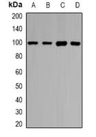 Polyclonal Rabbit anti-Human PIWIL1 / PIWI Antibody (IF, WB)