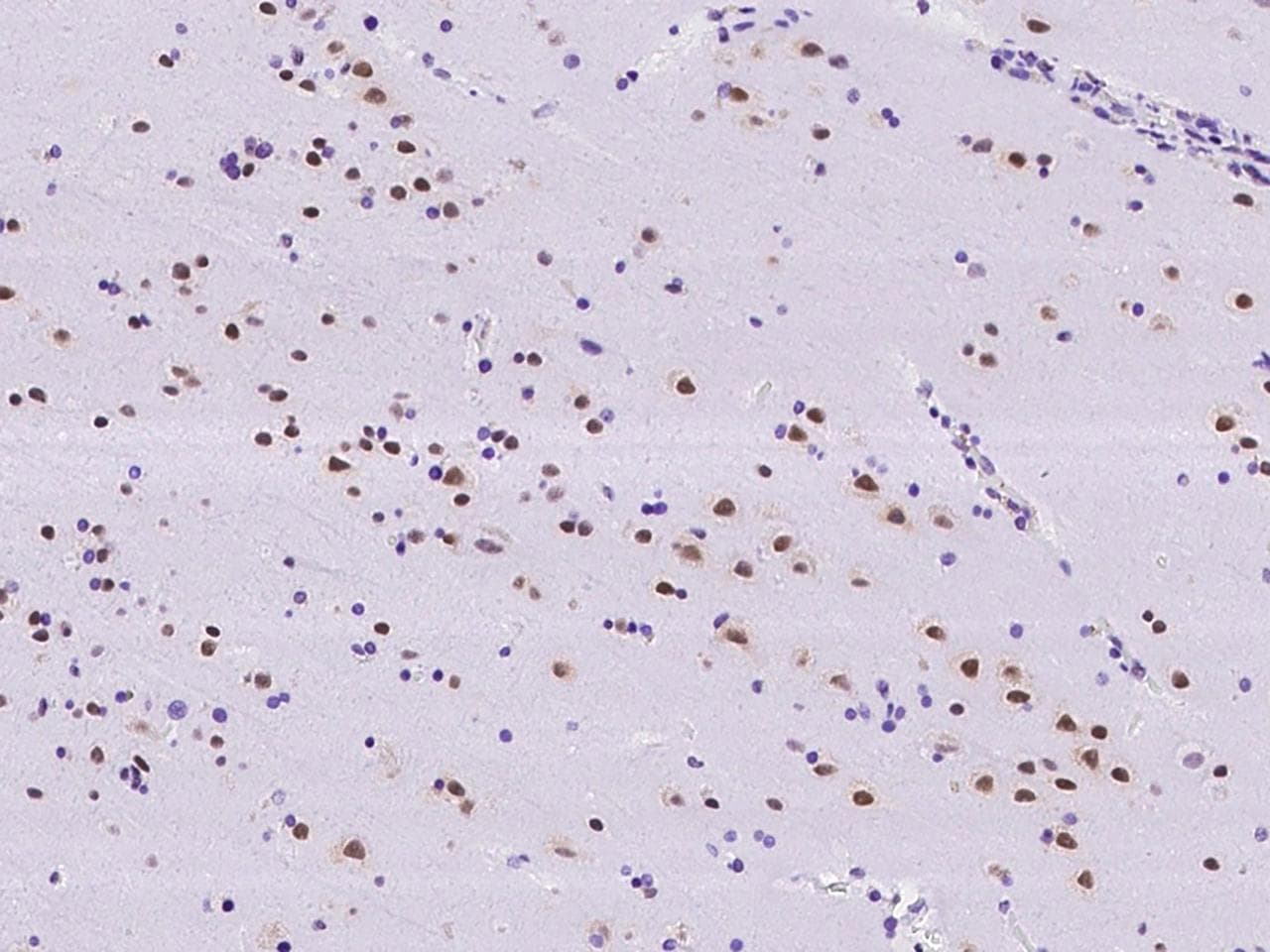 Polyclonal Rabbit anti-Human RBM6 / 3G2 Antibody (IHC)
