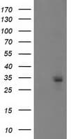 Monoclonal Mouse anti-Human PGAM2 Antibody (clone OTI4B12, IF, WB)