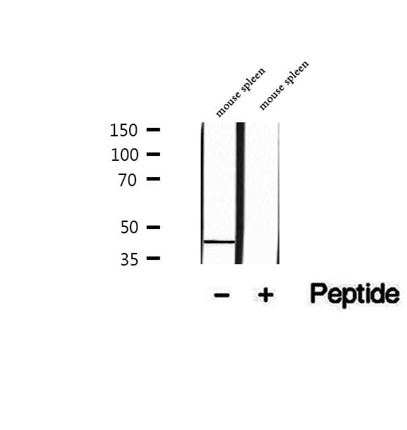 PARVB Antibody