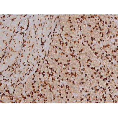 FAK / Focal Adhesion Kinase Antibody (phospho-Tyr397)