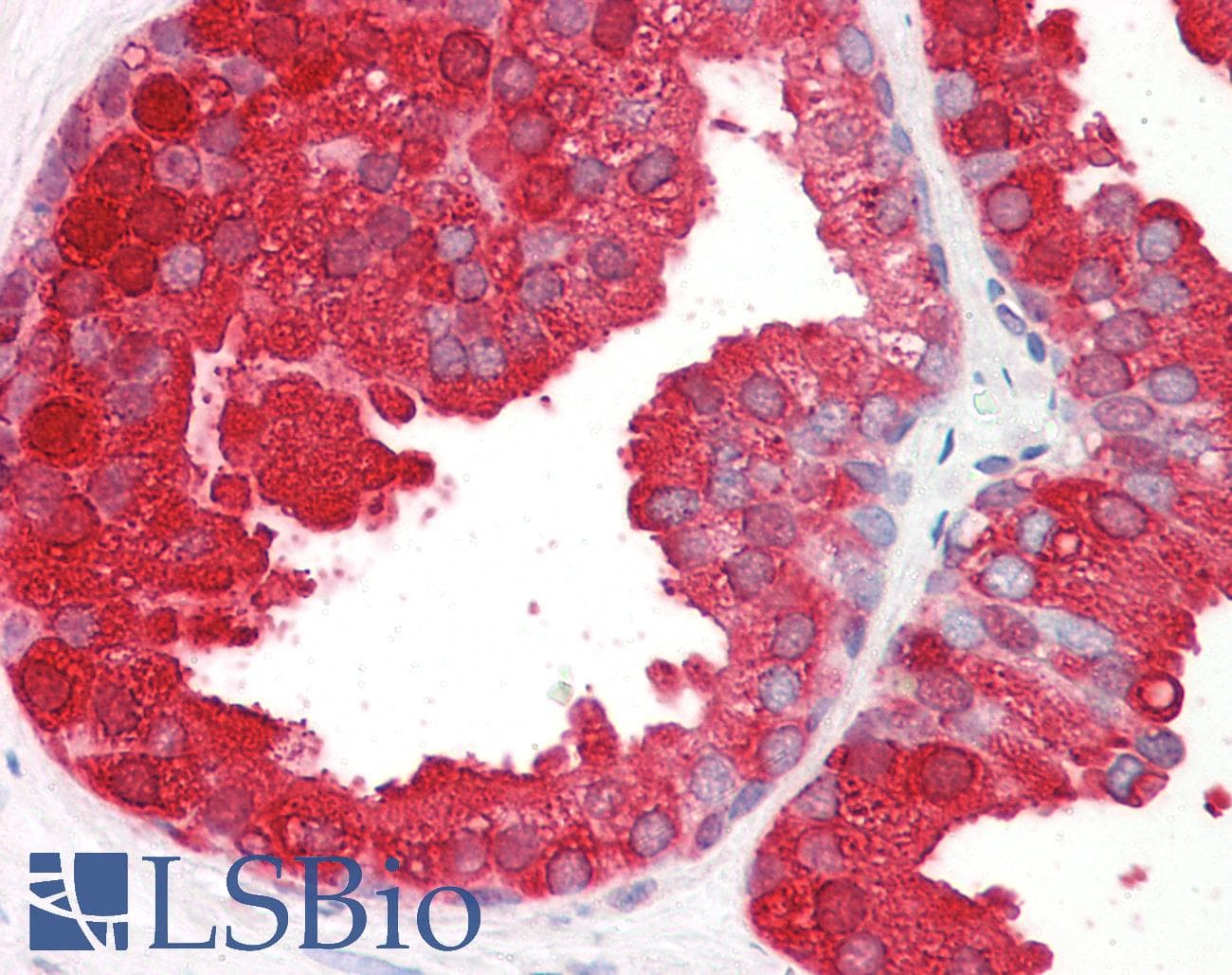 IHC-plus™ ACPP / PAP Antibody (aa269-282)