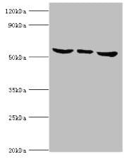 MAPK15 / ERK7 Antibody (aa1-95)