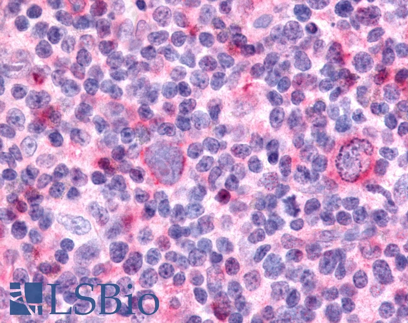 PathPlus™ Polyclonal Rabbit anti-Human PTPRE / PTP Epsilon Antibody (Cytoplasmic Domain, IHC)