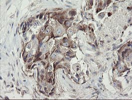 METAP2 Antibody (clone OTI1F6)