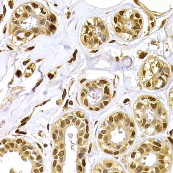 S100A4 / FSP1 Antibody