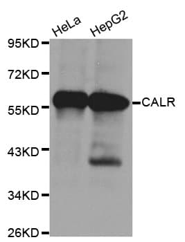 Polyclonal Rabbit anti-Human CALR / Calreticulin Antibody (IHC, IF, WB)