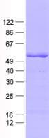 Human RBM22 Protein (Recombinant His, N-Terminal)