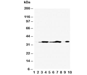 Polyclonal Rabbit anti-Human ANXA5 / Annexin V Antibody (aa88-102, IHC, WB)