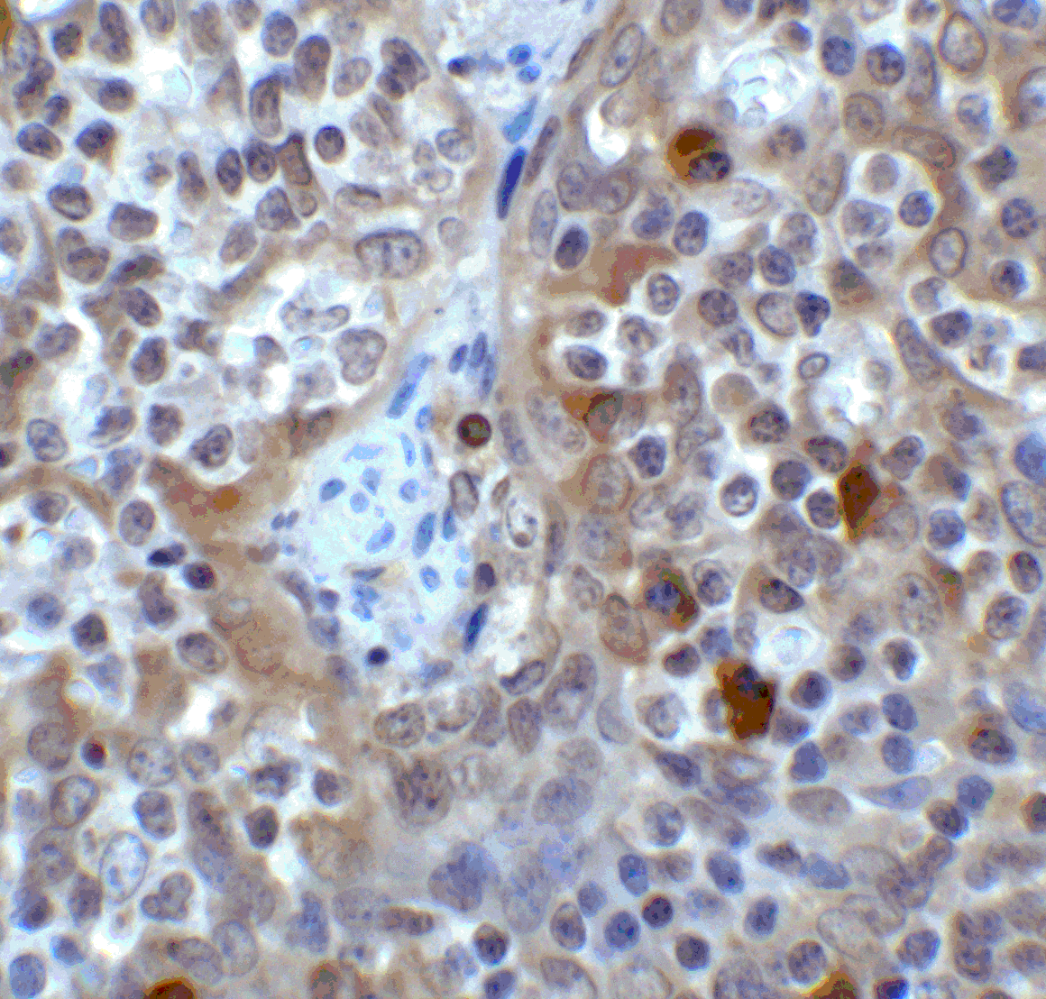 Polyclonal Rabbit anti-Human VSIR / GI24 / VISTA Antibody (IHC, IF, WB)
