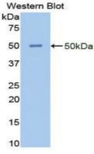 ENO2 / NSE Antibody (aa1-434)