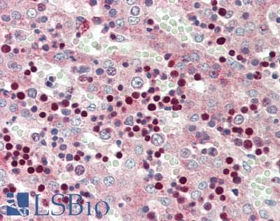 IHC-plus™ CUL3 / Cullin 3 Antibody (Internal)