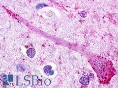 PathPlus™ Polyclonal Rabbit anti-Human GPR49 / LGR5 Antibody (Cytoplasmic Domain, IHC)