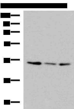 Polyclonal Rabbit anti-Human ISY1-RAB43 Antibody (IHC, WB)