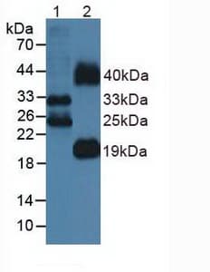 FLT3LG / Flt3 Ligand Antibody (aa27-189)