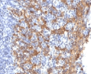Monoclonal Mouse anti-Human KRT14 / CK14 / Cytokeratin 14 Antibody (clone CTKN14-1, IHC, IF)