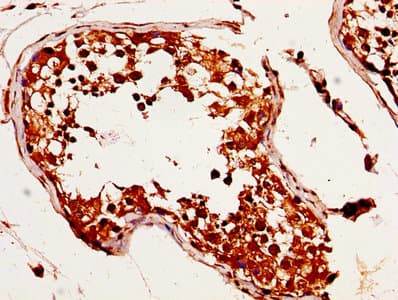MAGED2 Antibody