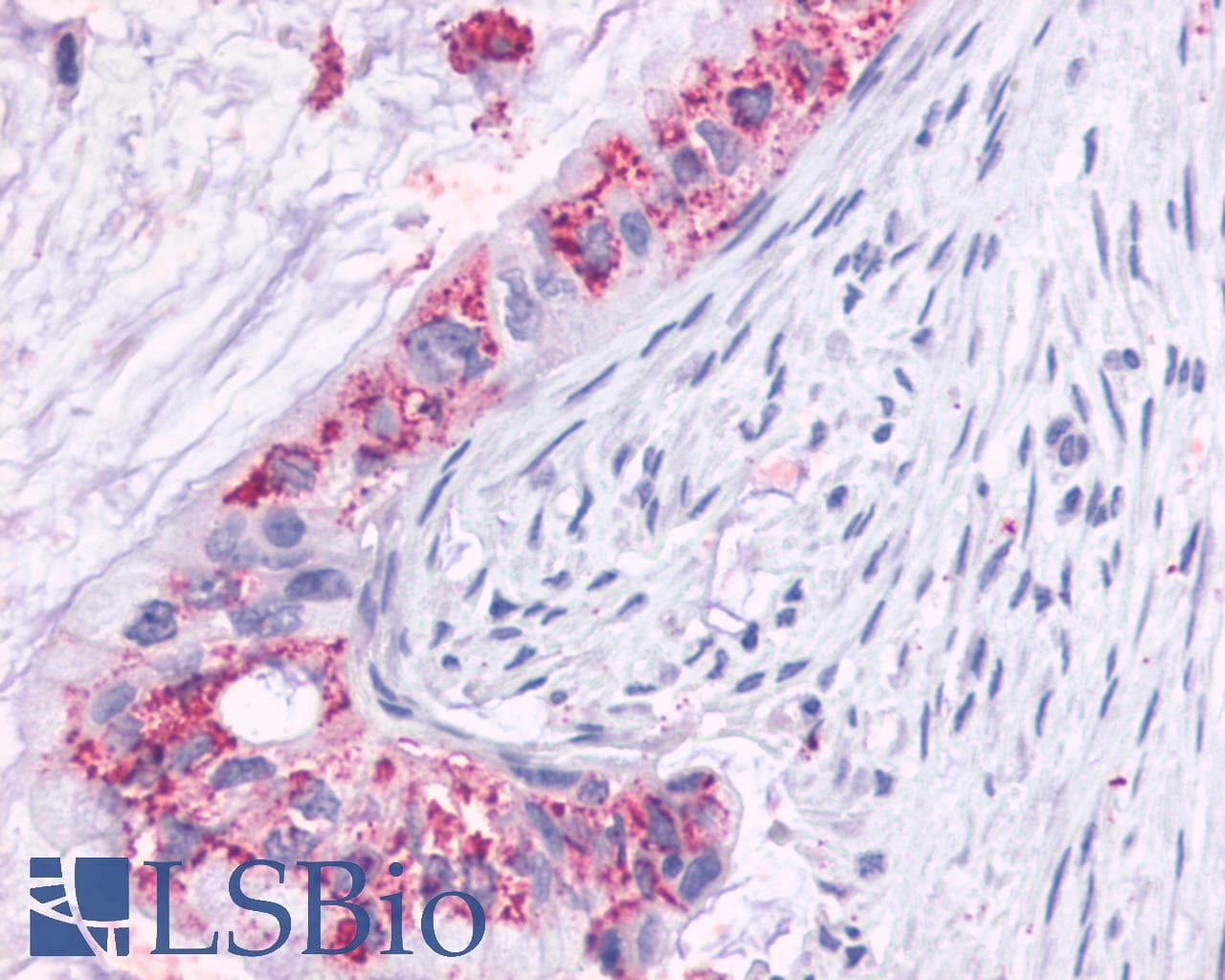 PathPlus™ SSTR1 Antibody (N-Terminus)
