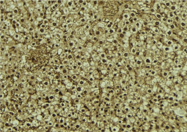 Polyclonal Rabbit anti-Human RBM4 / LARK Antibody (IHC, IF, WB)