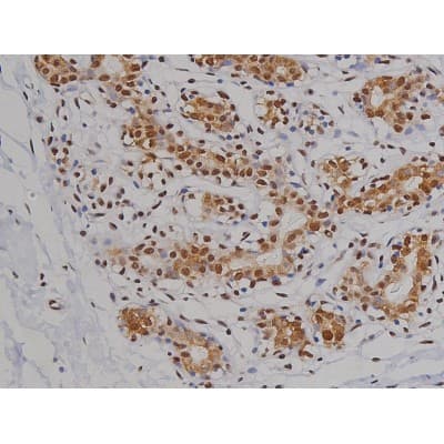 MAPT / Tau Antibody (phospho-Ser396)
