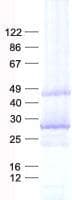 Human MAB21L1 Protein (Recombinant His, N-Terminal)