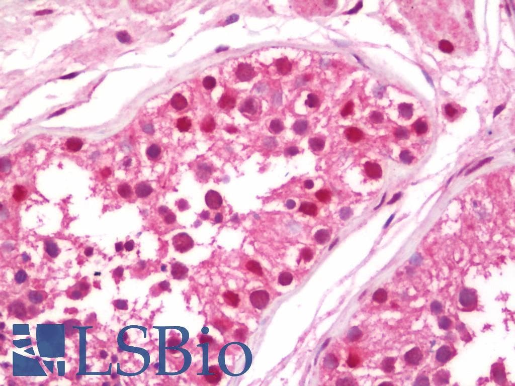 IHC-plus™ UBA1 / UBE1 Antibody (aa800-850)