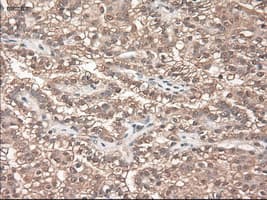 NTF3 / Neurotrophin 3 Antibody (clone OTI5C7)